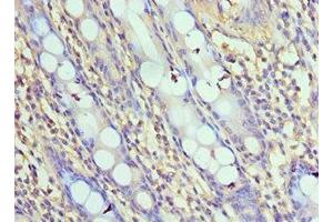 Immunohistochemistry of paraffin-embedded human colon tissue using ABIN7161654 at dilution of 1:100 (NLRC4 Antikörper  (AA 1-250))