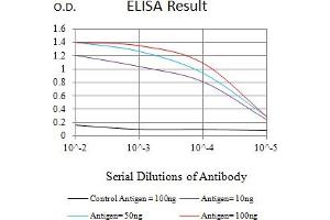 Black line: Control Antigen (100 ng),Purple line: Antigen (10 ng), Blue line: Antigen (50 ng), Red line:Antigen (100 ng) (CKM Antikörper  (AA 1-381))