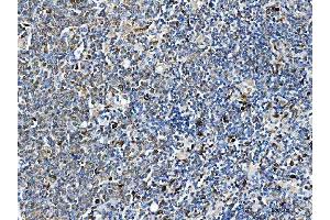 IHC analysis of ARHGAP45 using anti-ARHGAP45 antibody (ABIN7599740). (HMHA1 Antikörper  (AA 111-349))