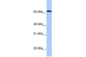 WB Suggested Anti-CCIN Antibody Titration: 0. (Calicin Antikörper  (C-Term))