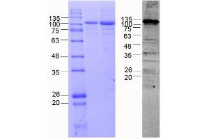 Cadherin 8 (CDH8) (AA 62-621), Fraction 8-9 (Cadherin 8 Protein (CDH8) (AA 62-621) (MBP tag))