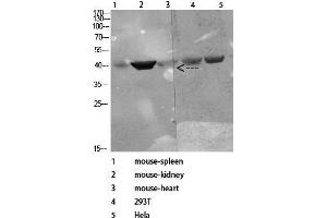 Western Blot (WB) analysis of specific cells using Antibody diluted at 1:1000.