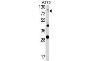 Image no. 1 for anti-Annexin A1 (ANXA1) (Middle Region) antibody (ABIN452740) (Annexin a1 Antikörper  (Middle Region))