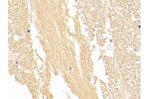 Detection of NSE in Human Cerebrum Tissue using Polyclonal Antibody to Enolase, Neuron Specific (NSE) (ENO2/NSE Antikörper  (AA 1-434))
