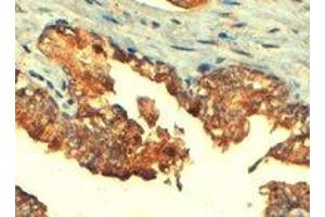 ABCC4 polyclonal antibody  (4 ug/mL) staining of paraffin embedded human prostate. (ABCC4 Antikörper  (C-Term))