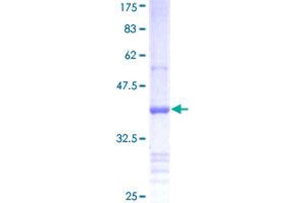 BMP3 Protein (AA 373-472) (GST tag)