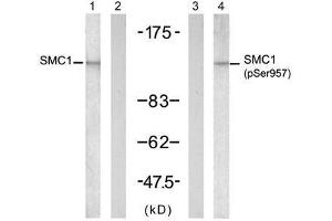 Western blot analysis of extract from K562 cells, untreated or treated with UV (20min), using SMC1 (Ab-957) antibody (E021190, Lane 1 and 2) and SMC1 (phospho-Ser957) antibody (E011198, Lane 3 and 4). (SMC1A Antikörper  (pSer957))