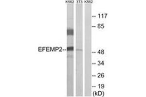 Western blot analysis of extracts from K562/NIH-3T3 cells, using EFEMP2 Antibody.