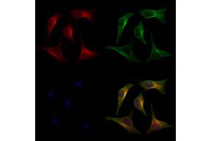 ABIN6266279 and ABIN6277274 staining 3 by IF/ICC.