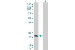 Western Blot analysis of RAB7L1 expression in transfected 293T cell line by RAB7L1 MaxPab polyclonal antibody. (RAB7L1 Antikörper  (AA 1-203))