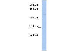WB Suggested Anti-TIGD4 Antibody Titration: 0. (TIGD4 Antikörper  (N-Term))