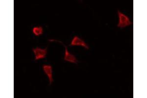 ABIN6269246 staining HeLa by IF/ICC. (STAT6 Antikörper  (Internal Region))