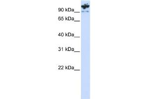 WB Suggested Anti-PCDHA6 Antibody Titration:  0.