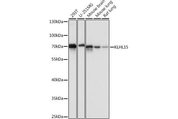 KLHL15 Antikörper  (AA 1-300)