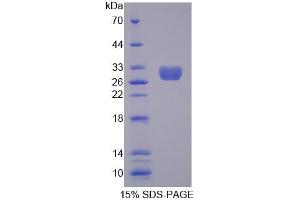 SDS-PAGE (SDS) image for Methyl CpG Binding Protein 2 (MECP2) (AA 1-177) protein (His tag) (ABIN6237798) (MECP2 Protein (AA 1-177) (His tag))