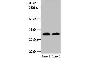 Western blot All lanes: TRNAU1AP antibody at 12 μg/mL Lane 1: MCF-7 whole cell lysate Lane 2: Jurkat whole cell lysate Secondary Goat polyclonal to rabbit IgG at 1/10000 dilution Predicted band size: 33, 21 kDa Observed band size: 33 kDa