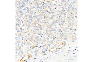 Immunohistochemistry analysis of paraffin-embedded rat stomach using Plectin Rabbit mAb at dilution of 1:1000 (40x lens). (PLEC Antikörper)