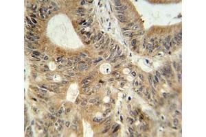 Immunohistochemistry (IHC) image for anti-ATP-Binding Cassette, Sub-Family C (CFTR/MRP), Member 3 (ABCC3) (AA 899-925) antibody (ABIN5647959)