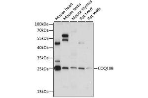 Western blot analysis of extracts of various cell lines, using COQ10B antibody. (COQ10B Antikörper)