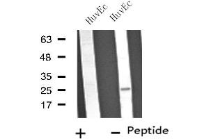 Western Blotting (WB) image for anti-Vesicle Transport through Interaction with T-SNAREs Homolog 1B (VTI1B) (Internal Region) antibody (ABIN6259233)
