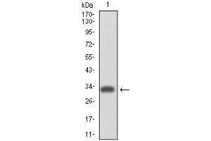 Western Blotting (WB) image for anti-Integrin alpha 4 (ITGA4) antibody (ABIN969530)