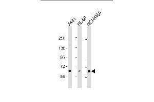 All lanes : Anti-PKC eta Antibody (N-term) at 1:1000 dilution Lane 1: A431 whole cell lysate Lane 2: HL-60 whole cell lysate Lane 3: NCI- whole cell lysate Lysates/proteins at 20 μg per lane. (PKC eta Antikörper  (N-Term))