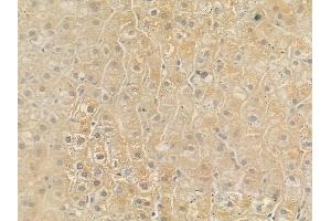 ABIN6257617 and ABIN6275640 at 1/100 staining human normal liver tissue by IHC-P. (MTERF Antikörper  (Internal Region))