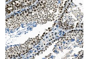 ABIN6265745 and ABIN6266869 at 1/100 staining Mouse testis tissue by IHC-P. (TRIP13 Antikörper  (C-Term))