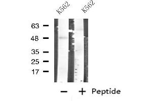Western blot analysis of extracts from K562 cells, using CARBOXYPEPTIDASE A1 antibody. (CPA1 Antikörper  (Internal Region))