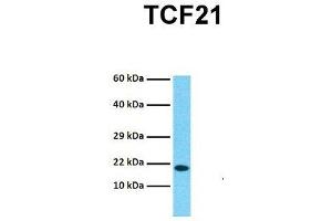 Western Blotting (WB) image for anti-Transcription Factor 21 (TCF21) (N-Term) antibody (ABIN2777930)