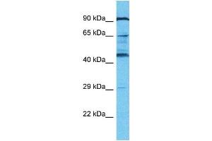 Western Blotting (WB) image for anti-KRAB-A Domain Containing 2 (KRBA2) (N-Term) antibody (ABIN2791626) (KRBA2 Antikörper  (N-Term))
