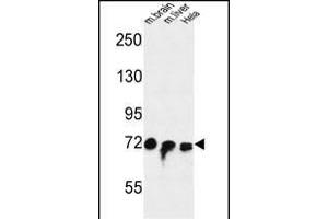 FA Antibody (Center) (ABIN653672 and ABIN2843004) western blot analysis in mouse brain,liver tissue and Hela cell line lysates (35 μg/lane).