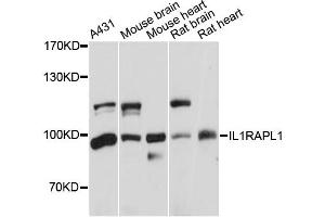 Western blot analysis of extracts of various cell lines, using IL1RAPL1 antibody (ABIN5971751) at 1:3000 dilution. (IL1RAPL1 Antikörper)