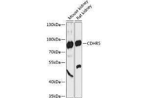 Western blot analysis of extracts of various cell lines, using CDHR5 antibody (ABIN6130563, ABIN6138301, ABIN6138302 and ABIN6217988) at 1:3000 dilution. (CDHR5 Antikörper  (AA 26-220))