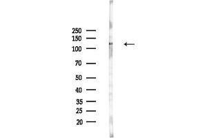 Western blot analysis of lysates from HUVEC cells(UV,30 min treatment), using MSH3 Antibody at 1/1000 dilution.