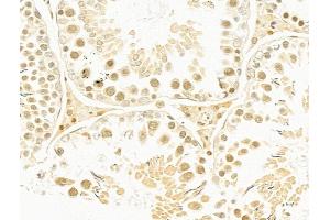 ABIN6263310 and ABIN6273056 at 1/100 staining Rat testis tissue by IHC-P. (MMS19 Antikörper  (Internal Region))