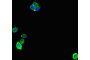 Immunofluorescent analysis of Hela cells using ABIN7143012 at dilution of 1:100 and Alexa Fluor 488-congugated AffiniPure Goat Anti-Rabbit IgG(H+L) (ANP32D Antikörper  (AA 1-131))