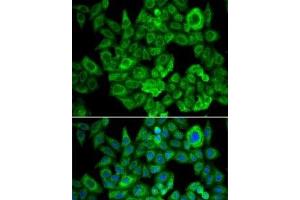 Immunofluorescence analysis of U2OS cells using OGDH Polyclonal Antibody