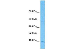 Host: Rabbit Target Name: TIMM10 Sample Type: 721_B Whole Cell lysates Antibody Dilution: 1. (TIMM10 Antikörper  (Middle Region))