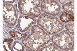 ABIN6266990 at 1/100 staining human kidney tissue sections by IHC-P. (FAP Antikörper  (Internal Region))