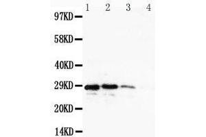 Lane 4: Recombinant Human CuEDC2 Protein 1. (CUEDC2 Antikörper  (C-Term))