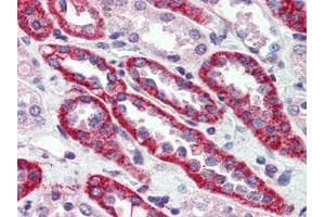 Human Kidney (formalin-fixed, paraffin-embedded) stained with CASRat 15 µg/ml followed by biotinylated goat anti-rabbit IgG secondary antibody, alkaline phosphatase-streptavidin and chromogen. (CASR Antikörper  (N-Term))
