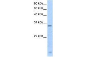 Image no. 1 for anti-Regulator of G-Protein Signalling 18 (RGS18) (N-Term) antibody (ABIN205001) (RGS18 Antikörper  (N-Term))
