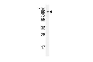 Western blot analysis of anti-ADCY2 Pab in Jurkat cell line lysates (35ug/lane). (ADCY2 Antikörper  (C-Term))