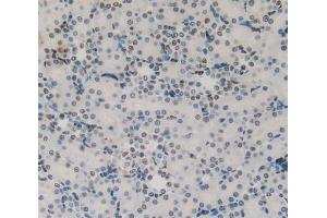 IHC-P analysis of kidney tissue, with DAB staining. (Cytokeratin 1 Antikörper  (AA 489-625))