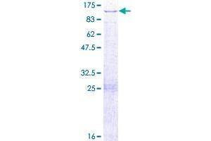 Image no. 1 for Dihydrouridine Synthase 3-Like (DUS3L) (AA 1-650) protein (GST tag) (ABIN1352091) (DUS3L Protein (AA 1-650) (GST tag))