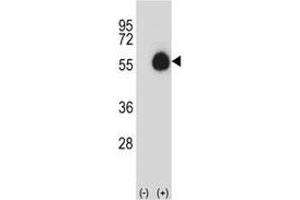 Western blot analysis of CD33 antibody and 293 cell lysate (2 ug/lane) either nontransfected (Lane 1) or transiently transfected (2) with the CD33 gene. (CD33 Antikörper  (AA 88-117))