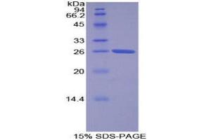 SDS-PAGE (SDS) image for Torsin Family 2, Member A (TOR2A) (AA 49-248) protein (His tag) (ABIN2127026)