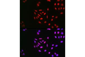 Immunofluorescence analysis of U2OS cells using Phospho-Cyclin E1-T395 Rabbit pAb (ABIN3019434, ABIN3019435, ABIN3019436 and ABIN6225368) at dilution of 1:100 (40x lens). (Cyclin E1 Antikörper  (pThr395))