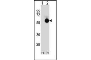 Western blot analysis of CTBP2 (arrow) using CTBP2 Antibody (N-term) Cat.